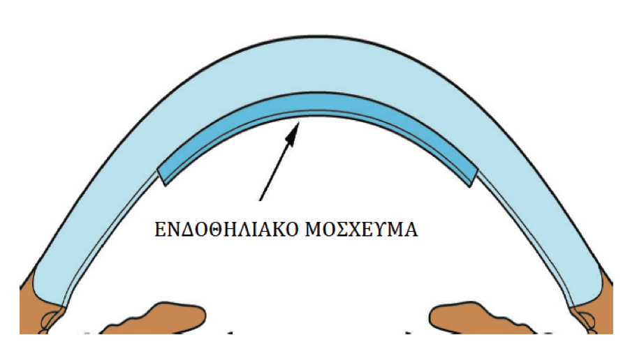 DSEK